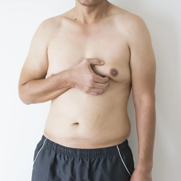 Chest Fat Bee Venom Gynecomastia Heating Oil